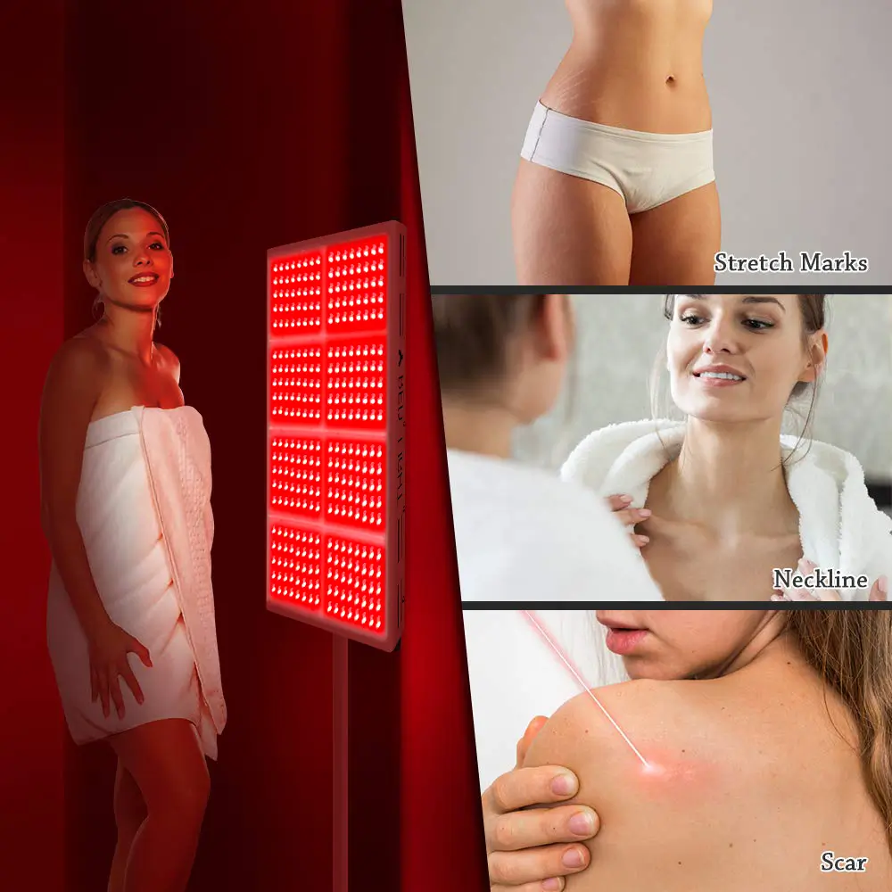 YOULUMI IRP010-08T 600W Red Light Therapy Panel – Skin Care & Wellness - Image 8