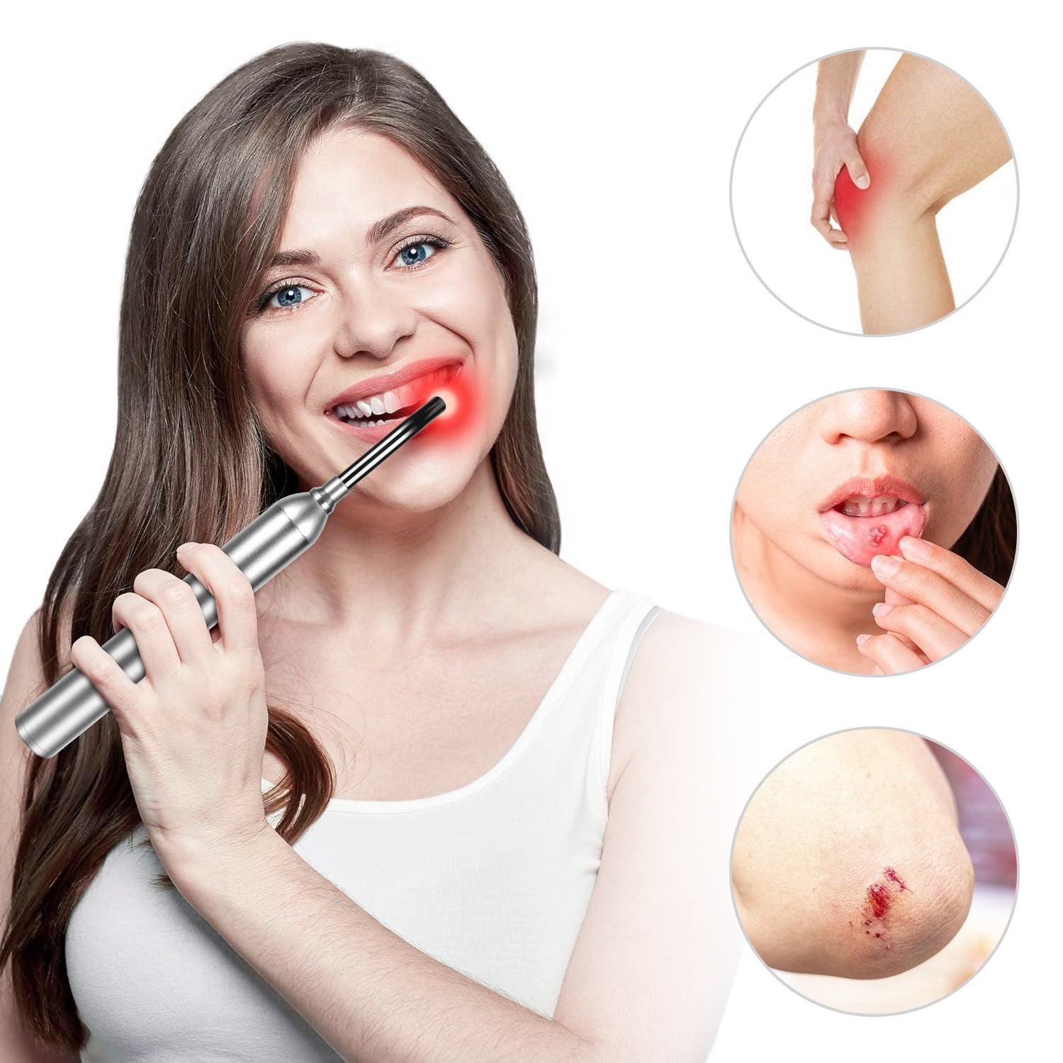 Youlumi Red Light Cold Sore Treatment Device - Image 4
