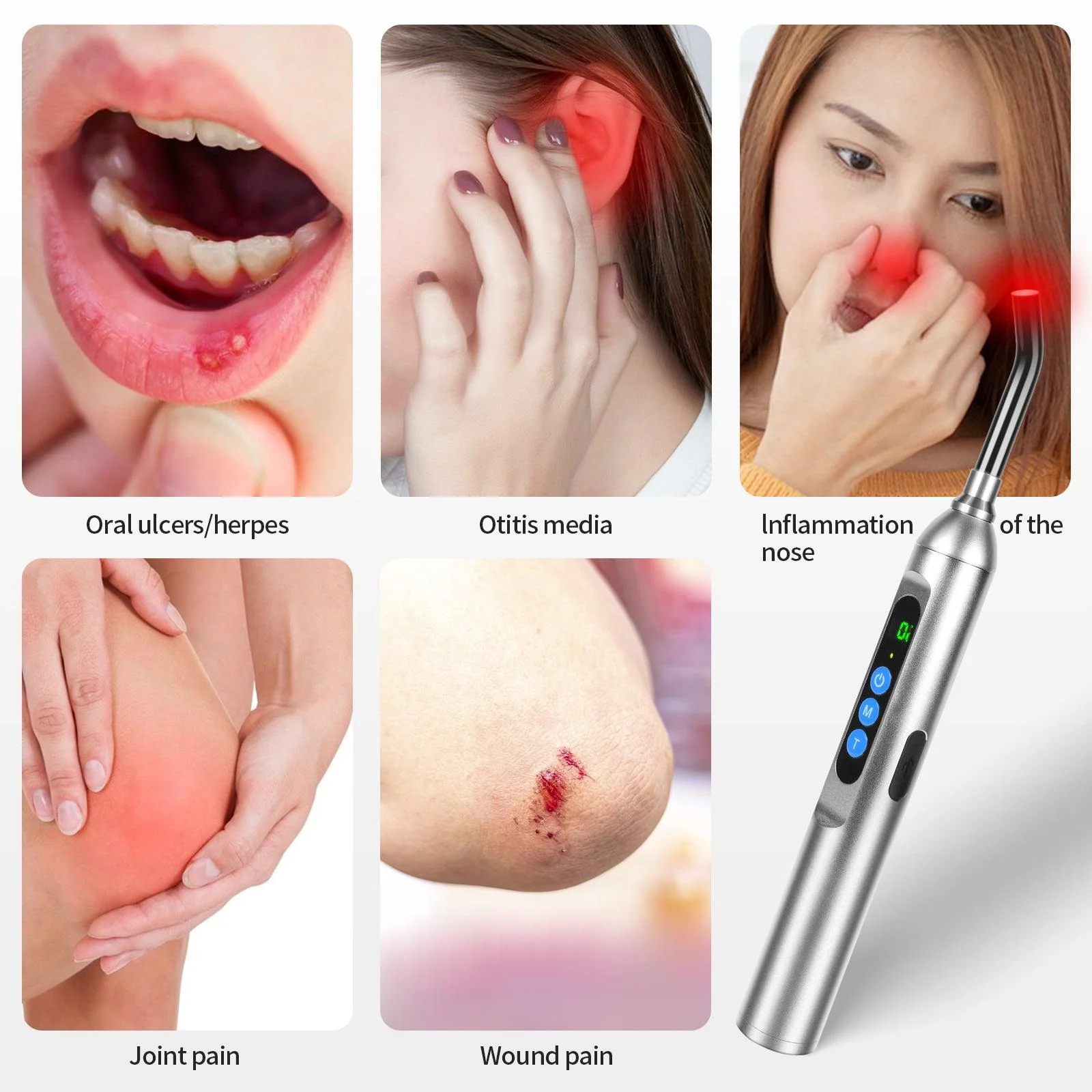 Youlumi Red Light Cold Sore Treatment Device - Image 5