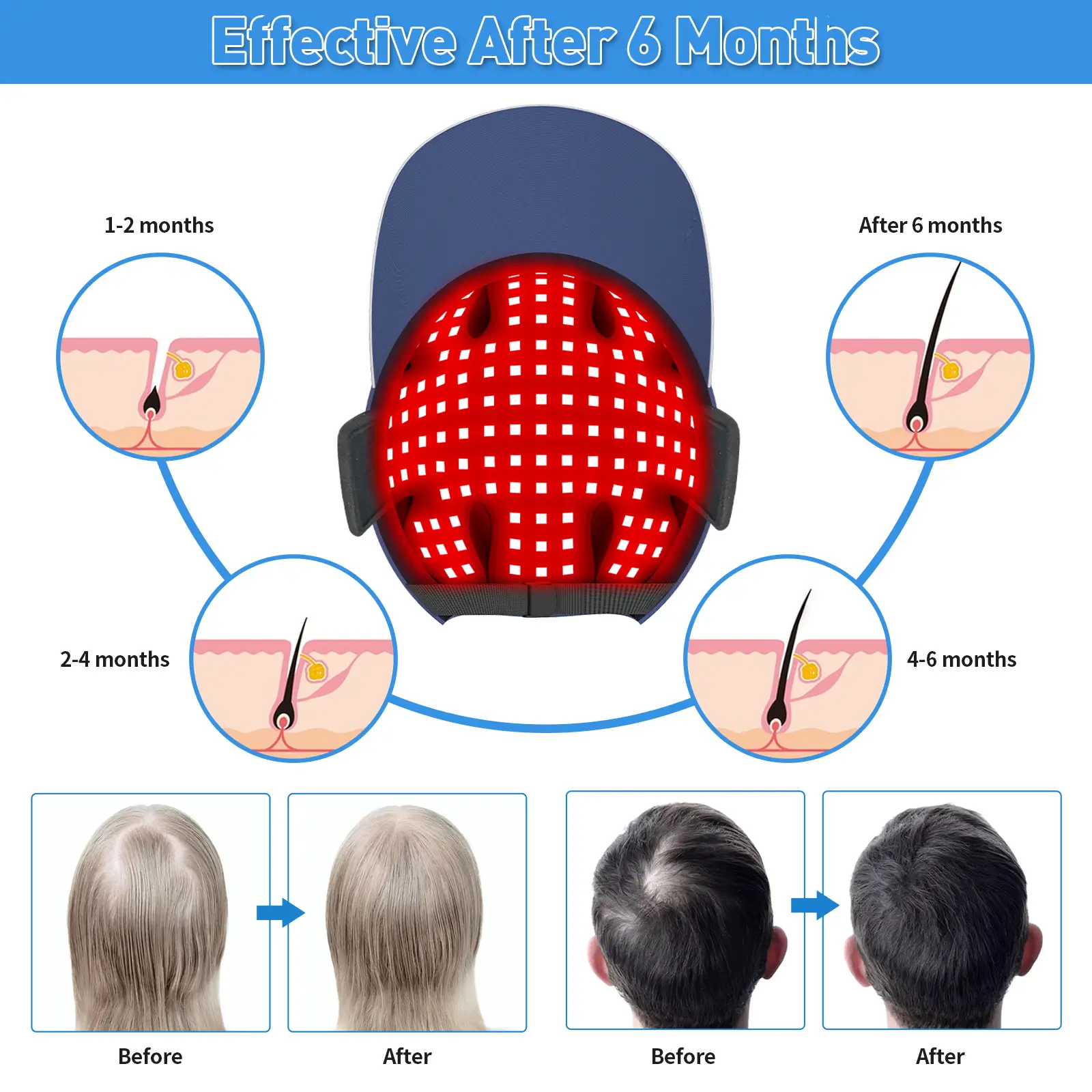 YOULUMI Red Light Therapy for Hair Growth - Image 3